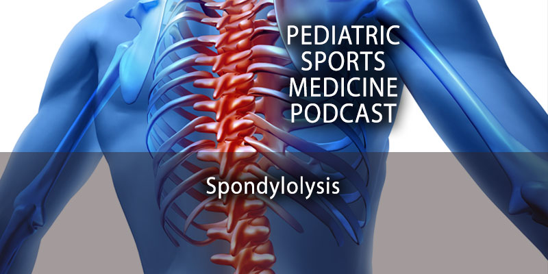 Spondylolysis -- The Pediatric Sports Medicine Podcast